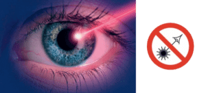 risque laser yeux